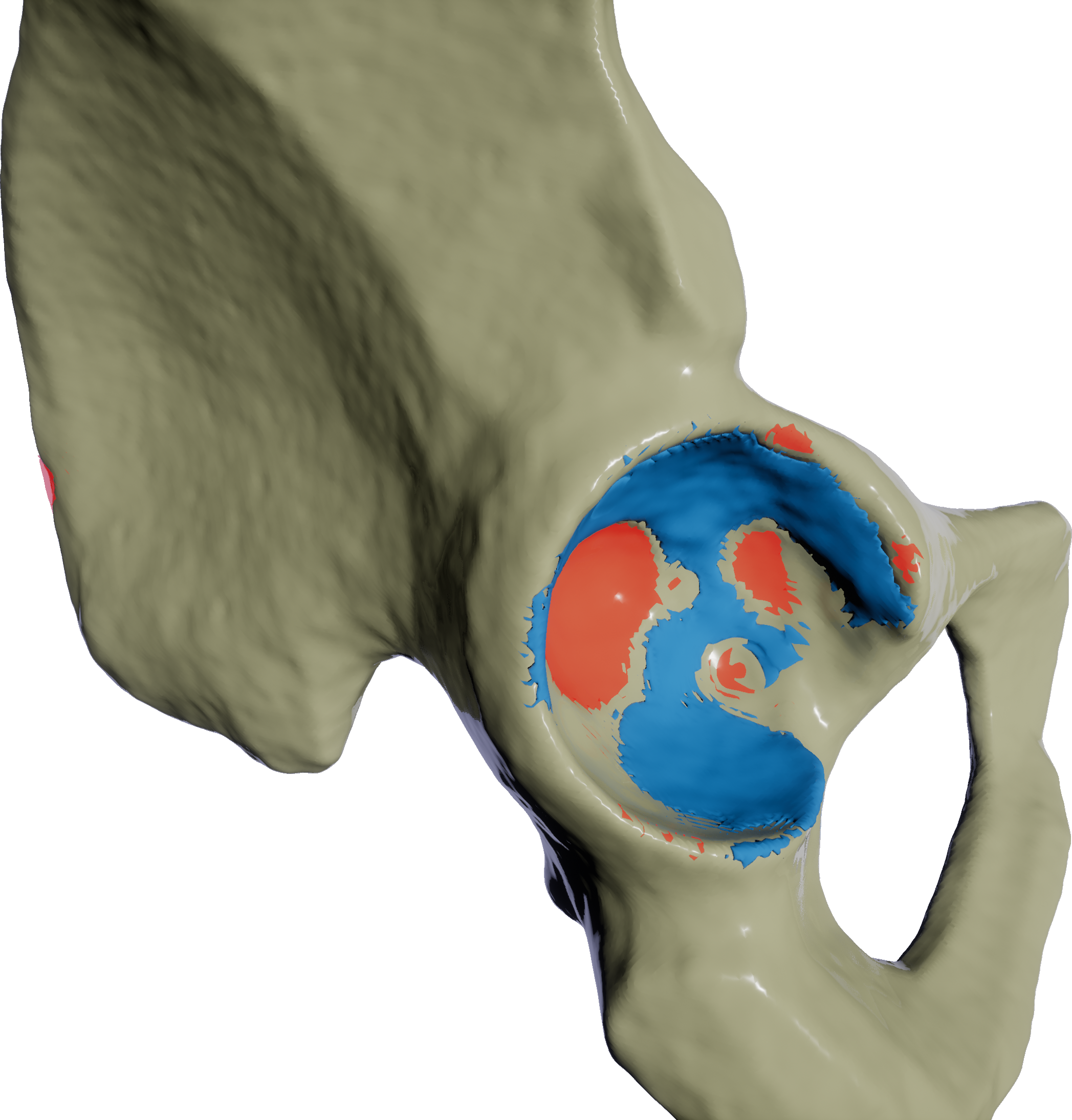Marching cubes rendering of a hip socket that is represented by an implicit surface.