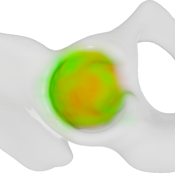 Visualization of the found density distribution.