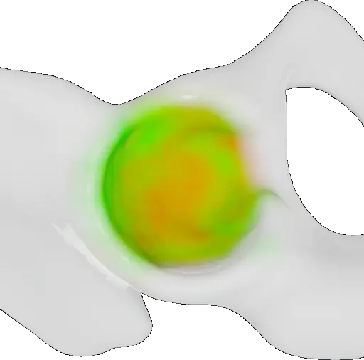 Visualization of the found density distribution.